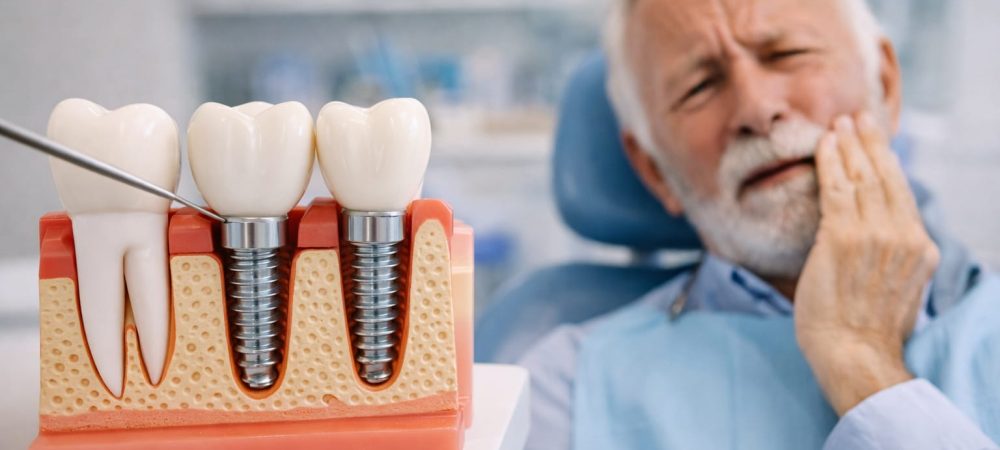 Dental implant model showing how implants replace missing tooth roots in the jaw